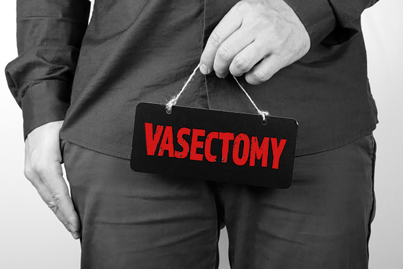 Vasektomie
